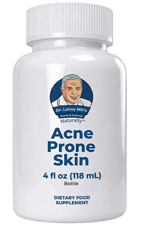 acne prone skin img3