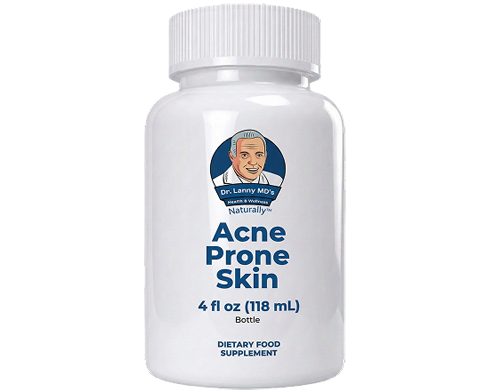 acne prone skin img6