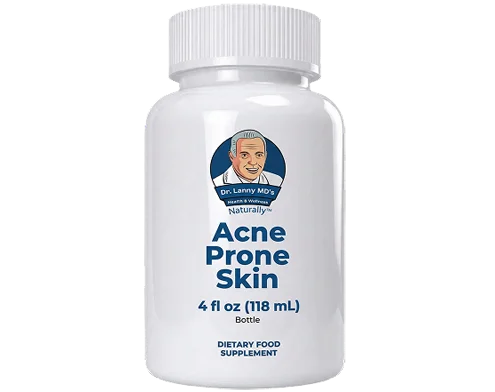 Acne Prone Skin